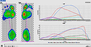 biomechanical analysis