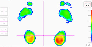 biomechanical analysis