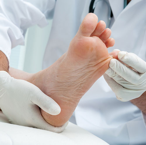 foot analysis